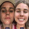 100% 식품 성분, 푸드 그레이드 천연 화장품 Edible Beauty. 에더블뷰티 & 슬리핑 뷰티 퓨리파잉 무스 슬립 마스크 50g. 천연 유기농 화장품 전문 쇼핑몰 원파인즈. 에더블뷰티 공식판매처.